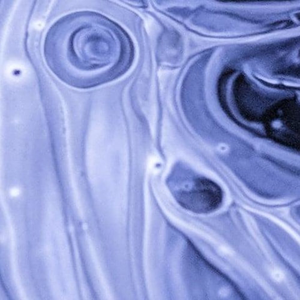 Image for ADVANZ PHARMA enters into an exclusive agreement with Alvotech to commercialise a proposed biosimilar to Xolair® (omalizumab)